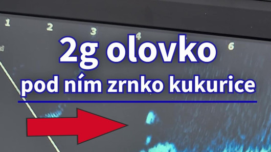 🏆 Neuveriteľná Citlivosť Sonaru: Vidíme Každú 2mm Peletu! 🤯 (Live Sonar Test) #sonary #live 🏆 Neuveriteľná Citlivosť Sonaru: Vidíme Každú 2mm Peletu! 🤯 (Live Sonar Test) #sonary #live