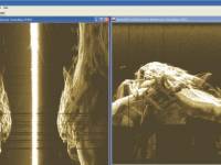 VN Orava sonar Lowrance HDS - jediné reálne zobrazenie VN Orava sonar Lowrance HDS - jediné reálne zobrazenie